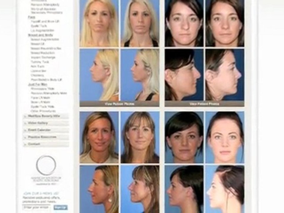 Dr Calvert- Plastic Surgery Los Angeles