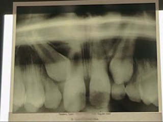 EDH Orthodontist Dr. Guess uses new free rewards program!