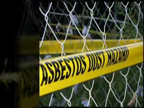 Diffuse Malignant Pleural Mesothelioma