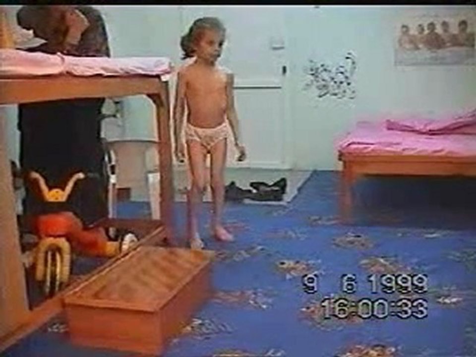 SPINABIFIDACDANLATIMI