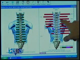 New treatment for migraines in newington, ct