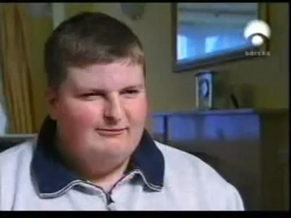 Sindrome de Prader-Willi