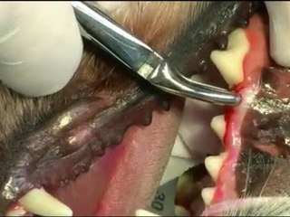 Simple tooth extraction