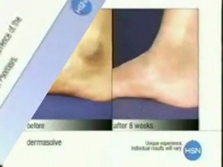 Types of Psoriasis and Treatment Options 🩺