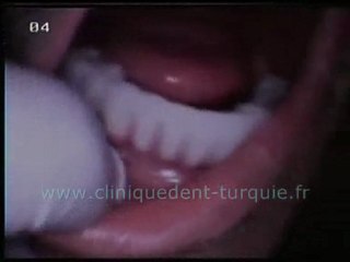 Erdal Orla fin du traitement