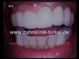 Mme Klohn fin du traitement