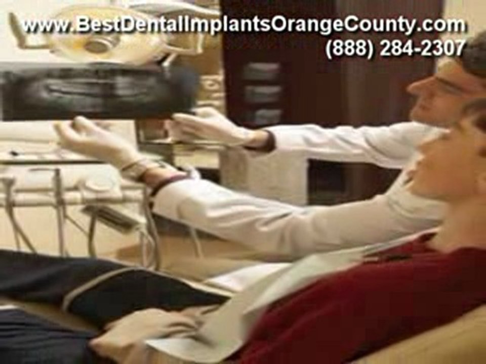 Find the Best Dental Implant in Orange County