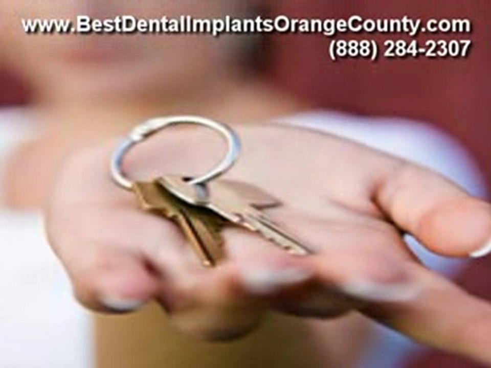 Find the Best Implants Dental in Orange County California
