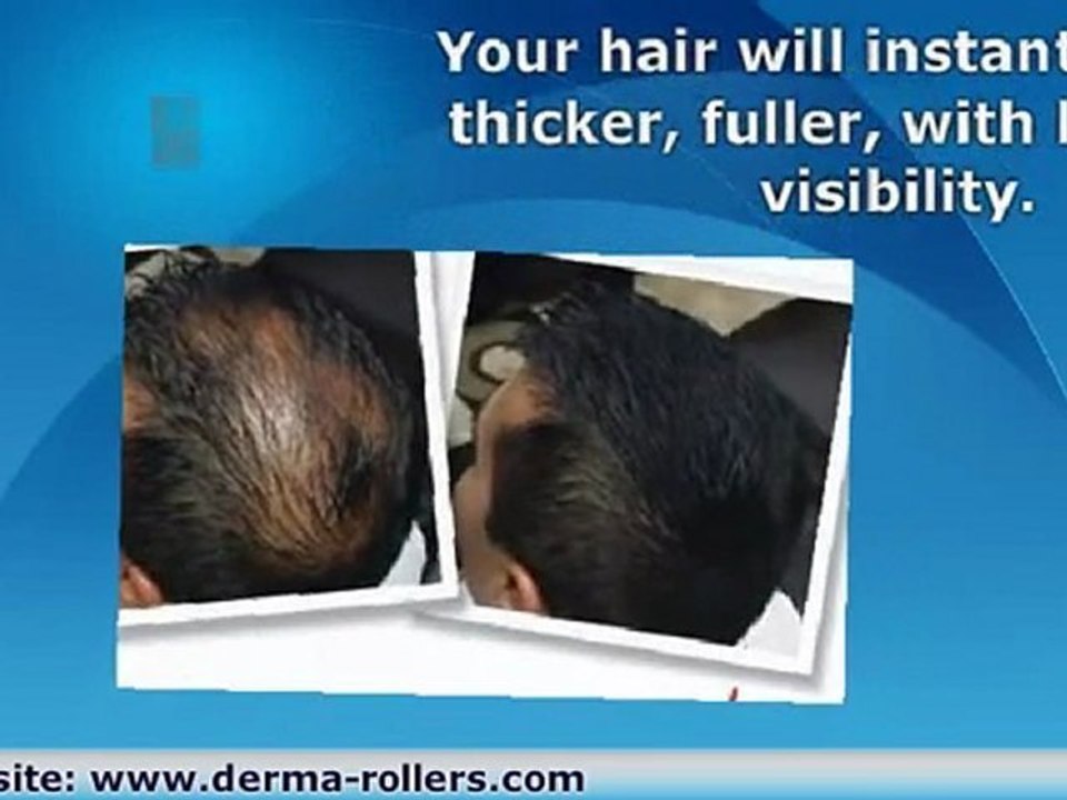 Thicken Hair