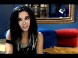 Bill kaulitz avant, aprés....