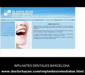 Odontologo barcelona Is Dental Implant Covered By Your Insur