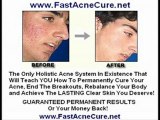 Cure Rosacea - Rosacea Treatment Facial Rosacea