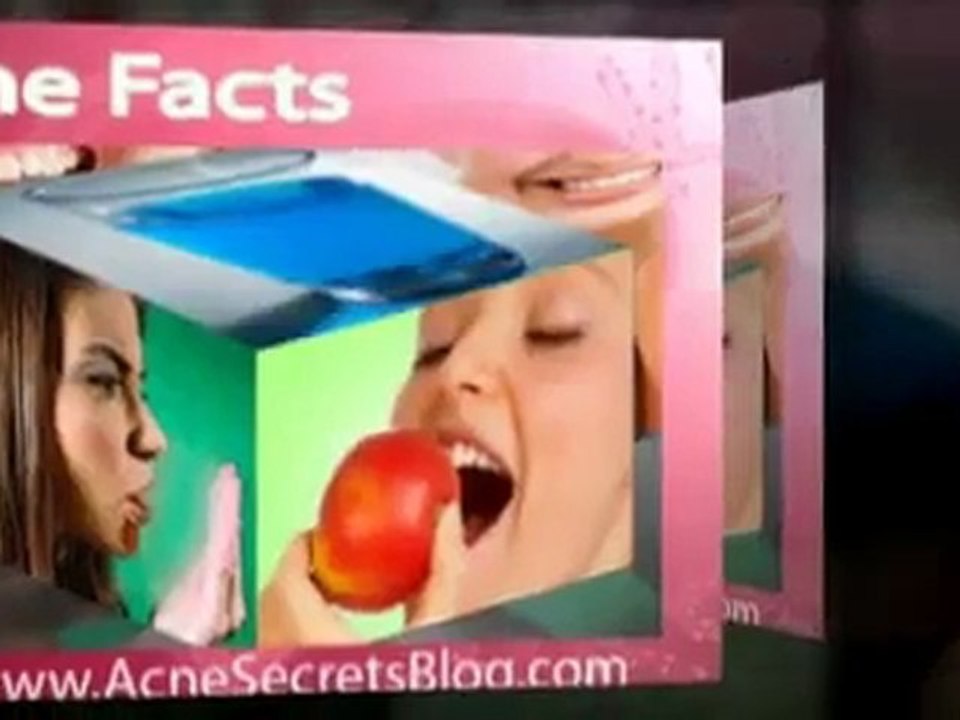 acne facts