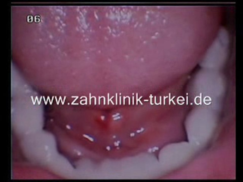 Anette Gotal (Keramik Brücke)