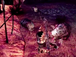 Dragon Age Origins Awakening - The Childrens