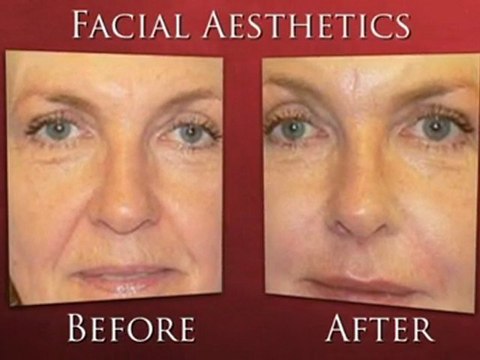 Non Surgical Facial Rejuvenation UK – Red Sky Dental Spa