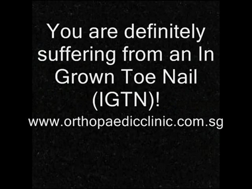 Ingrown Toe Nail