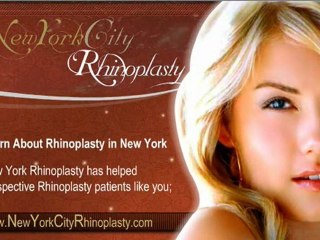 Rhinoplasty New York 01