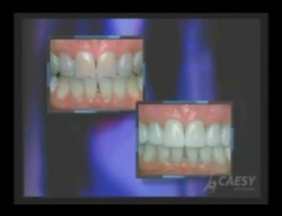 Dental whitening techniques by Dr. Sahabi