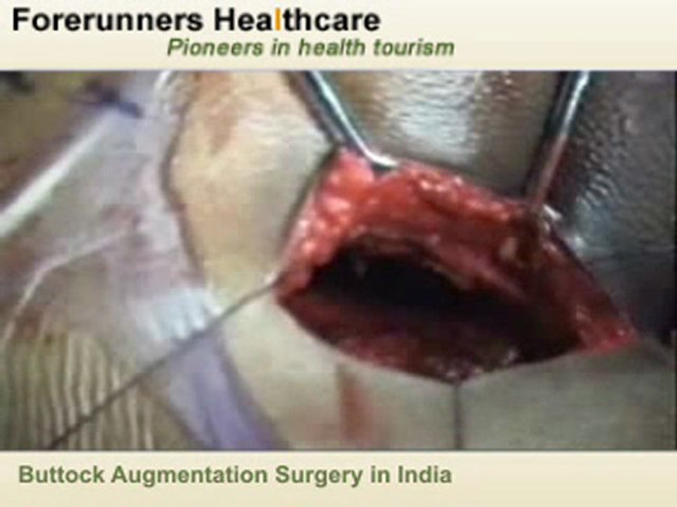 Get Cosmetic Surgery under Certified Cosmetic Surgeons in In