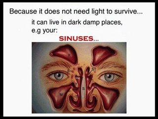 Post Nasal Drip Treatment focus on killing...