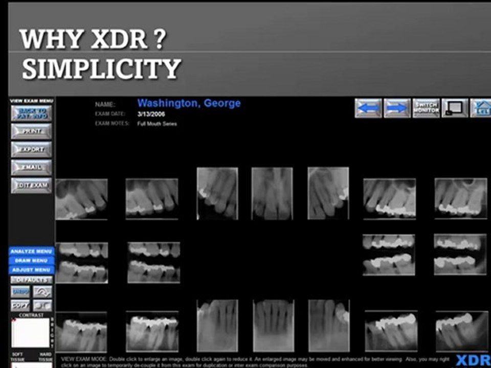 Dental Xray Sensor Sale