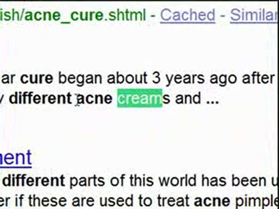 Acne Cure Search