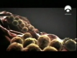 Bacterias resistentes: Estafiloloco aureo