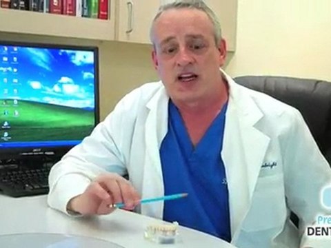 Lowry Dentist Shows Dental Implants as Denture Replacement