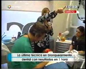 Blanqueamiento Dental Madrid - Spa Dental - Dentalcare