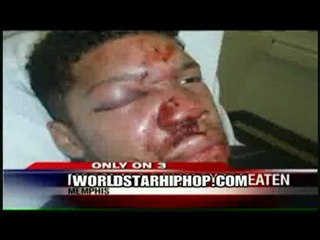 17 Year Old McDonalds Employee Beaten Badly By His Manager