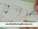 Snoring Cures Are The Solution