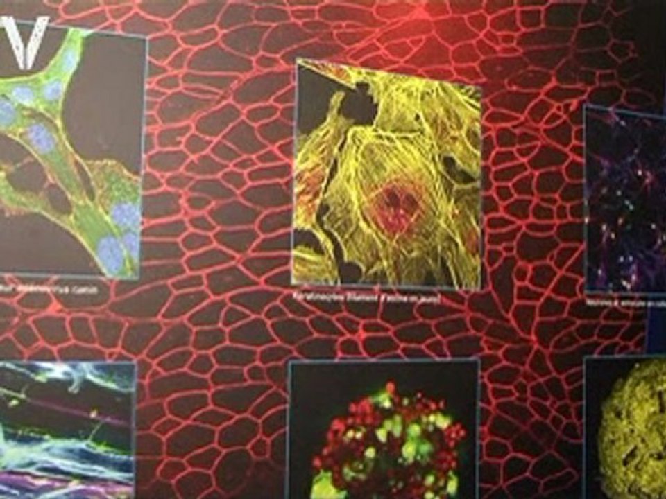 Maladies rares : quelles avancées grâce au Téléthon ?