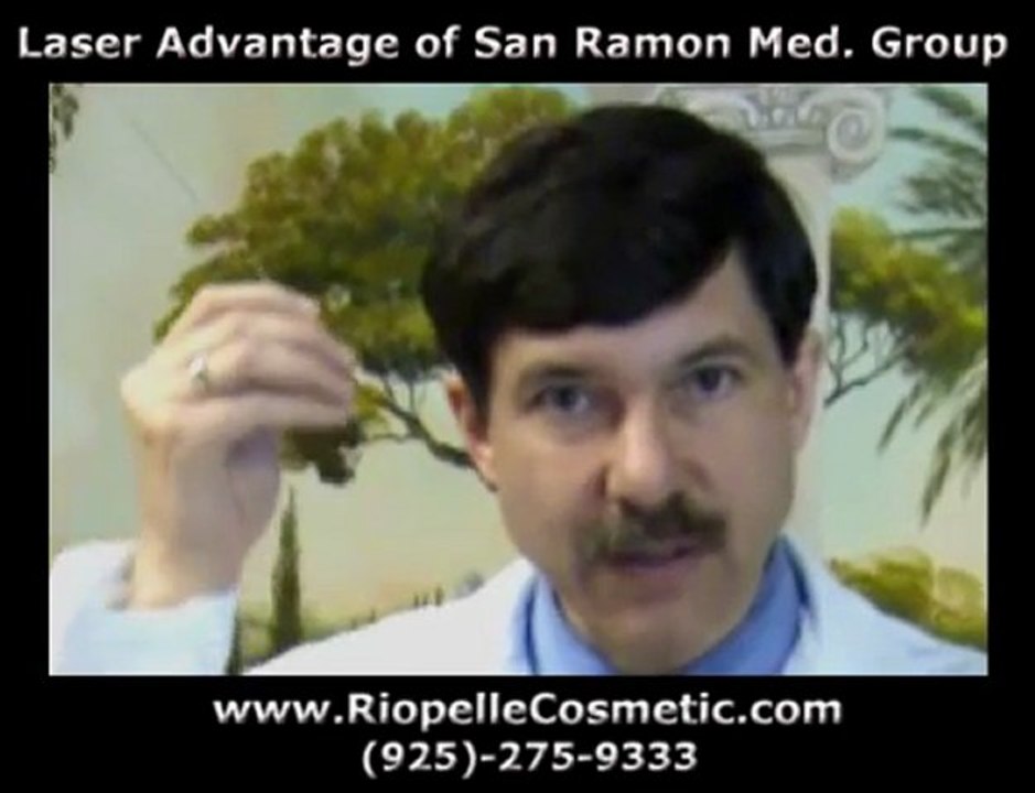 Cosmetic Surgery suture lift by Dr. Jeffrey Riopelle