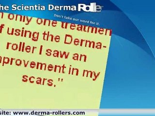 Tummy Tuck Scar Treatment