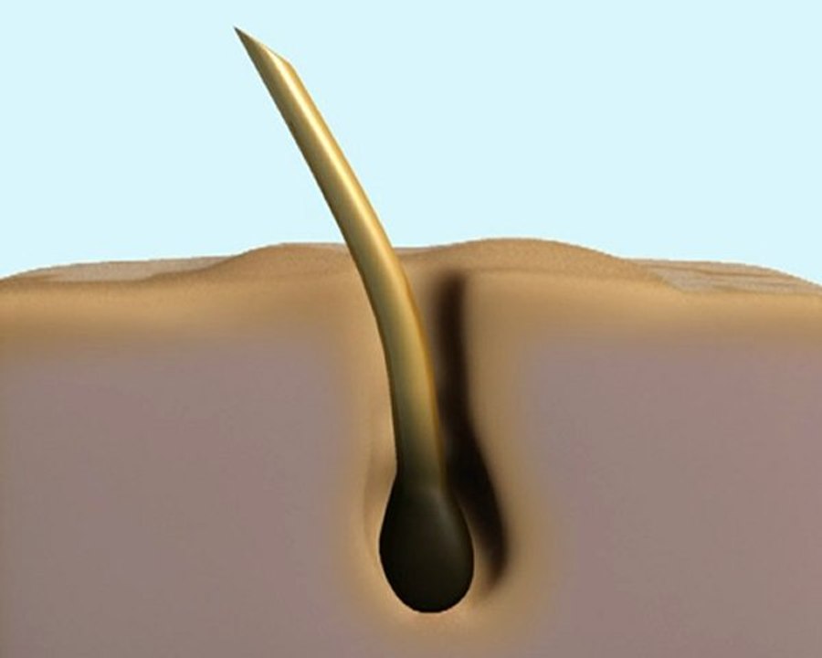 depilation_2