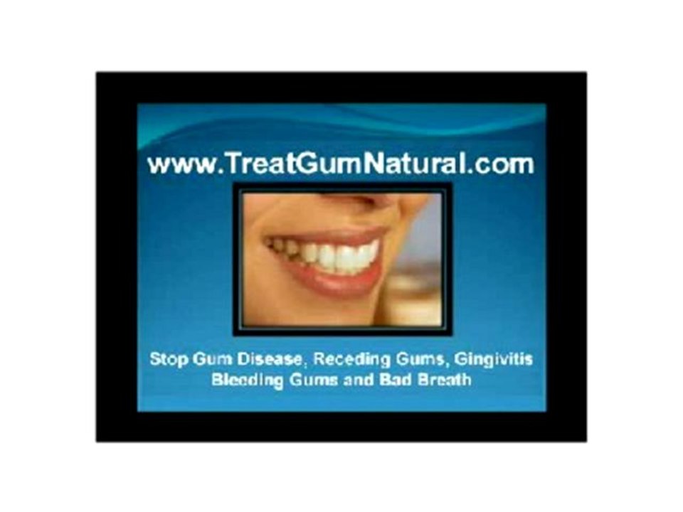 Stop Gingivitis, Cure Gingivitis, Heal Gingivitis