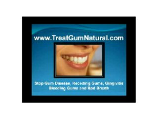 Stop Gingivitis, Cure Gingivitis, Heal Gingivitis