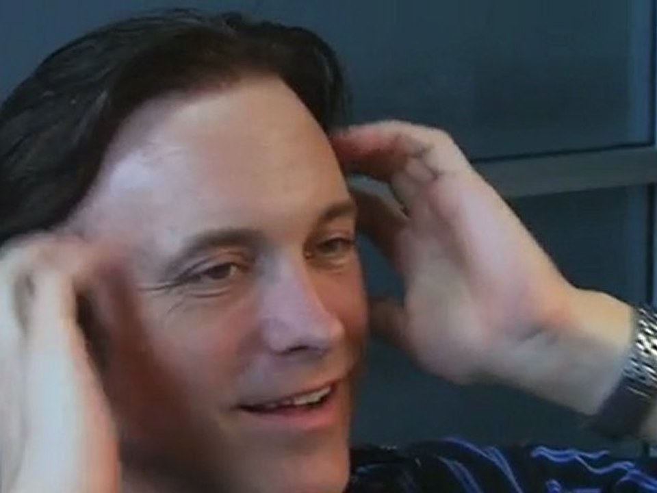 Hair Replacement Make-Over with Farrell Client Jason