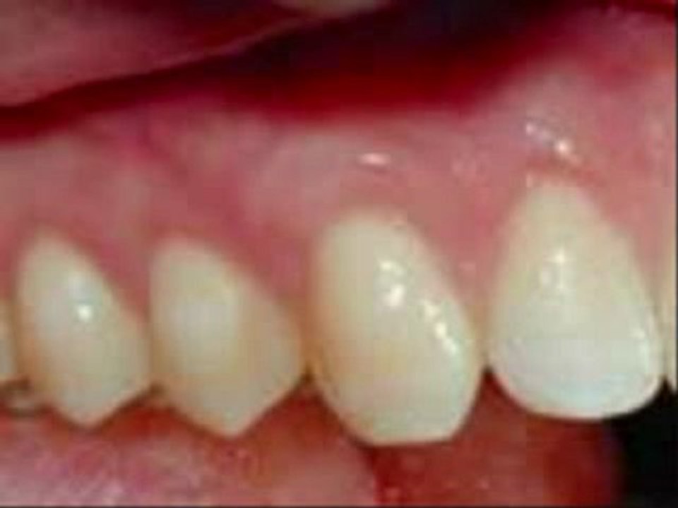 Stop Gum Disease Disease Gum Stop Gum Stop Disease Stop Gums