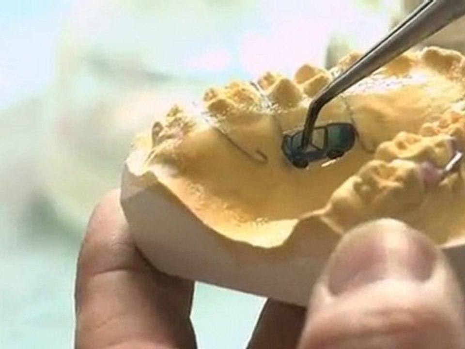 Orthodontie laser : création appareils dentaires - Nice