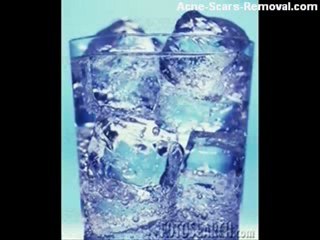 All Natural Blackhead Removal -  Natural Facial Clean Tips