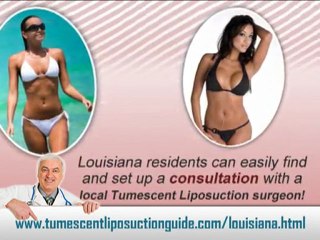 Tumescent Liposuction Louisiana