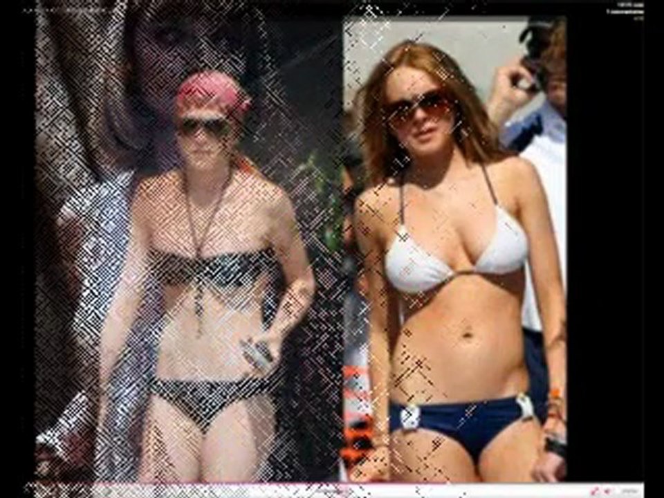 Vive la chirurgie esthétique- People