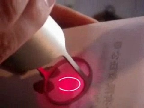 co2 fractional laser skin resurfacing/ skin rejuvenation op