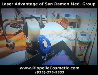 Zerona Laser Treatment by Dr.Riopelle|Alamo CA 94507|NBC Re