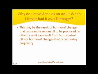 What Causes Adult Acne?