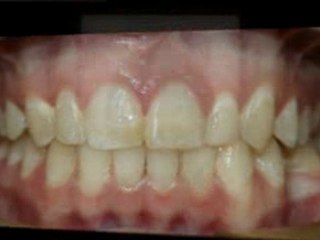 Greeley Orthodontist - Super Smiles By Doctor K