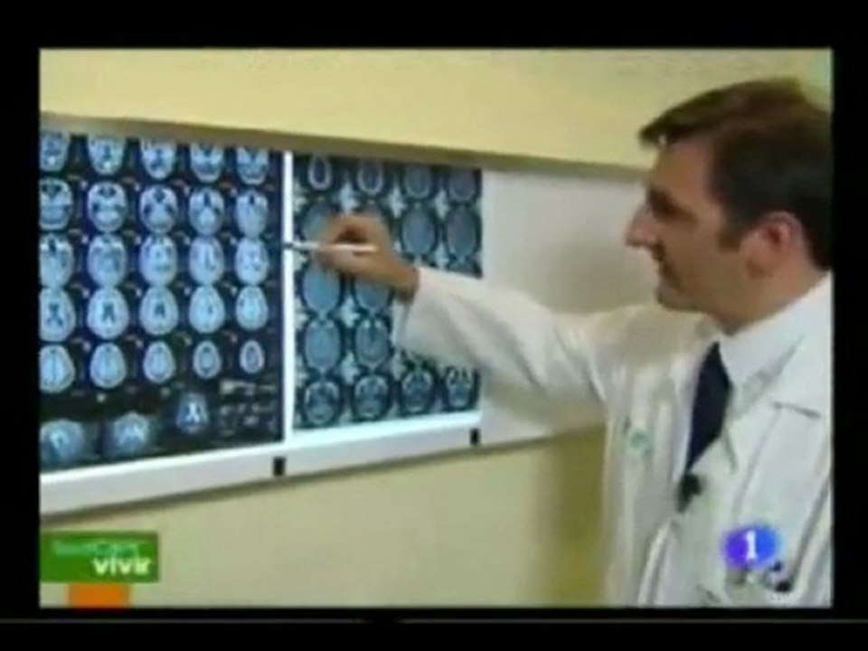 Diagnostico de la demencia