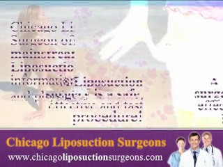 Chicago Liposuction Surgeons